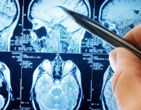 A key strength of UCD&rsquo;s Biomedical Engineering research activity is its collaboration with clinicians in UCD&rsquo;s teaching hospitals. This engagement ensures that research addresses and is relevant to real clinical needs, leading to the development of innovative applications and clinical use.\n