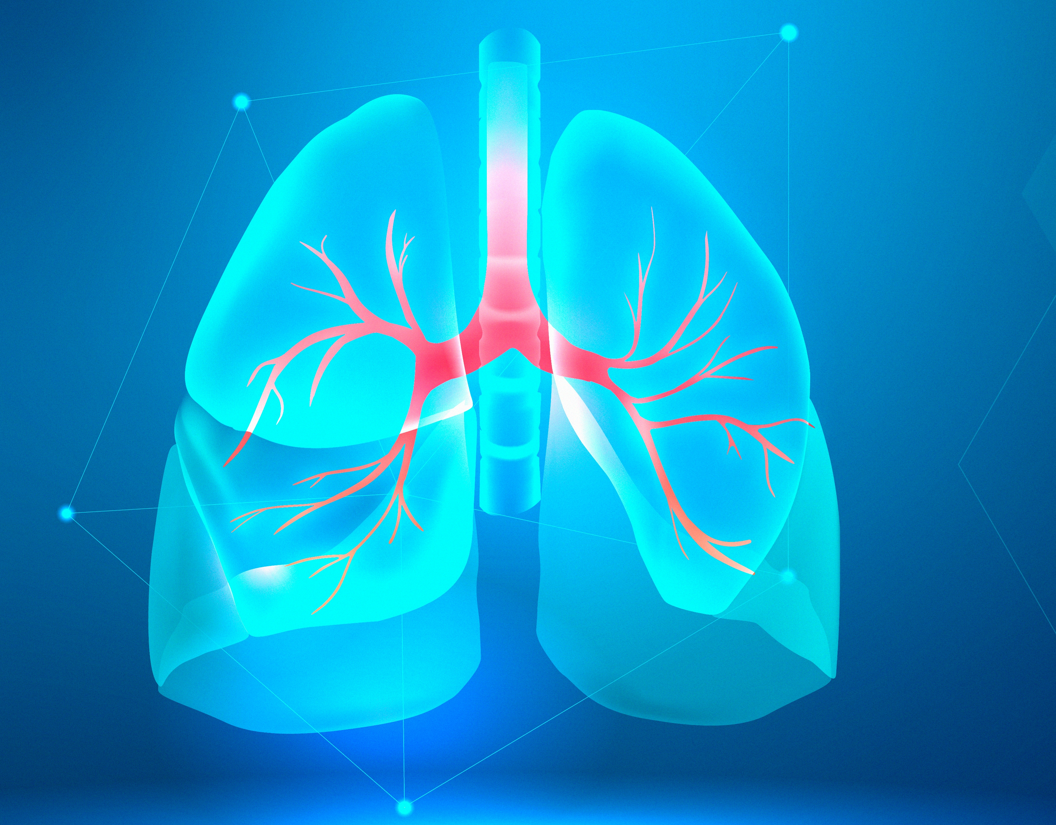 Transatlantic collaboration drives innovation in Cystic Fibrosis Care and Cost Research