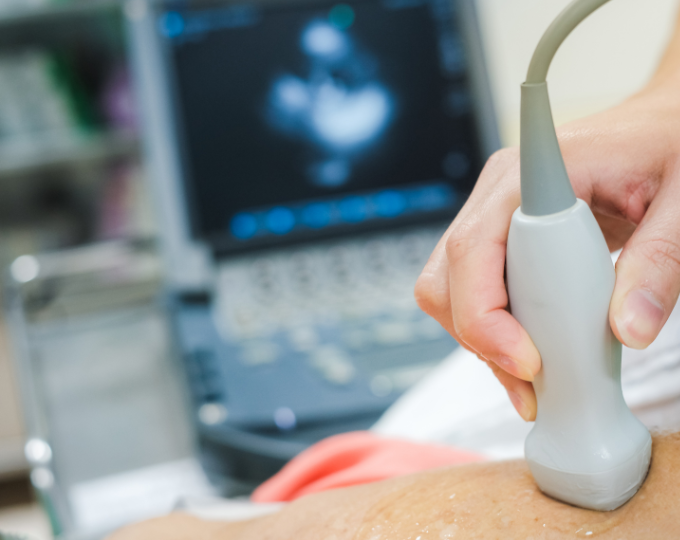 Sonographer Canva